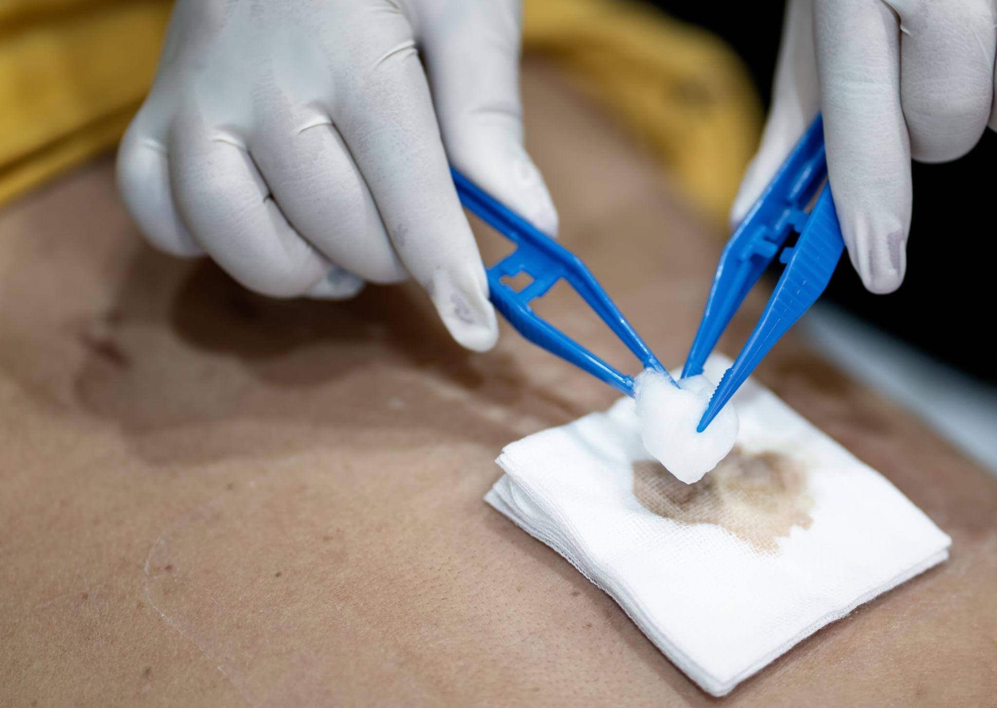 Wound cleaning and dressing at Klinik Dr Care Rawang